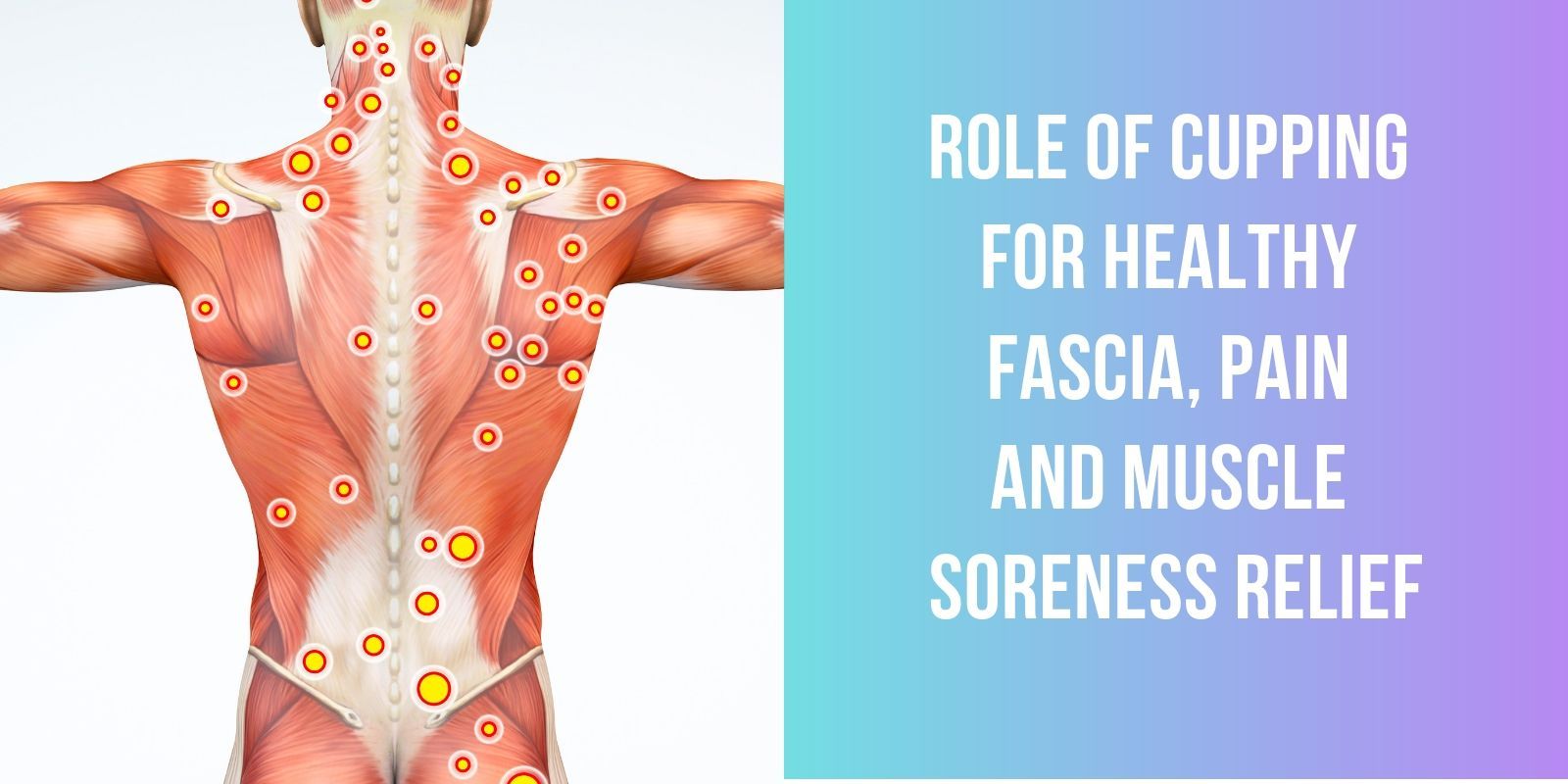 Role of Cupping for Healthy Fascia, Pain and Muscle Soreness Relief